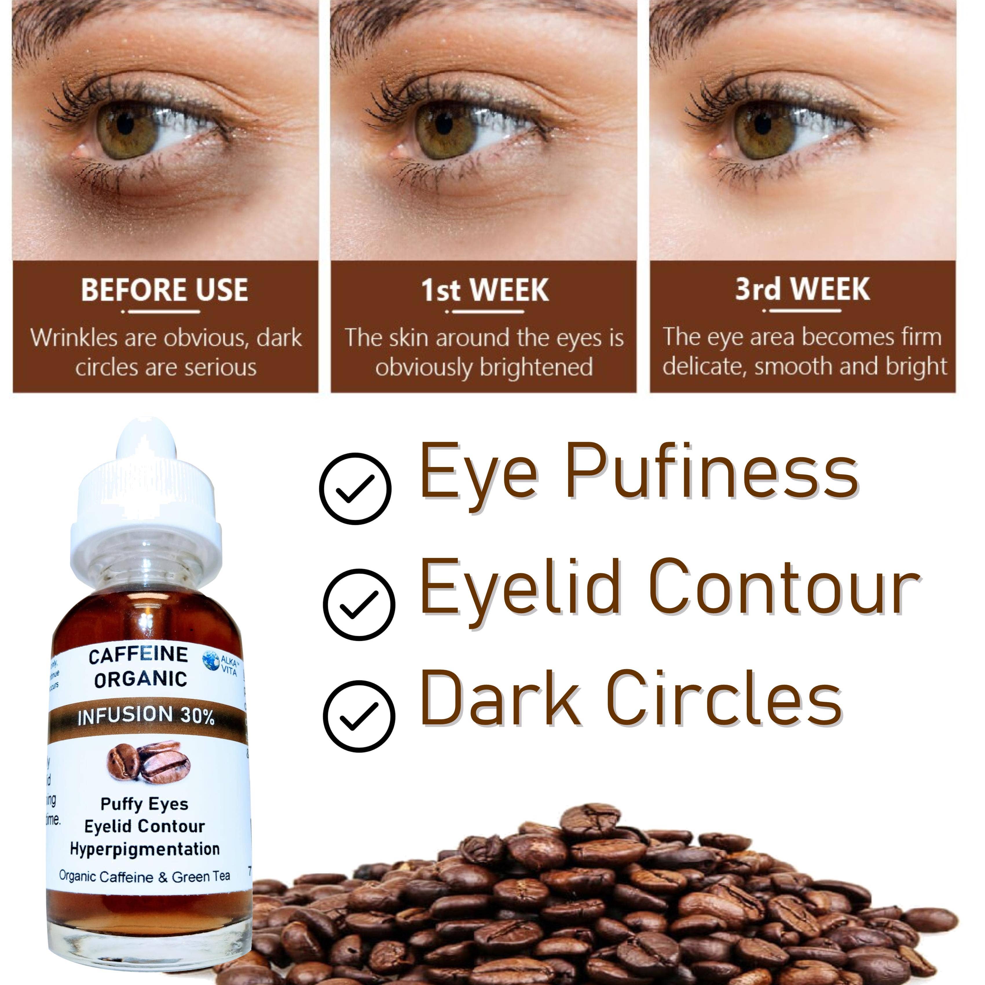 Puffy Eyes Caffeine 30% Infusion The Highest Concentration
