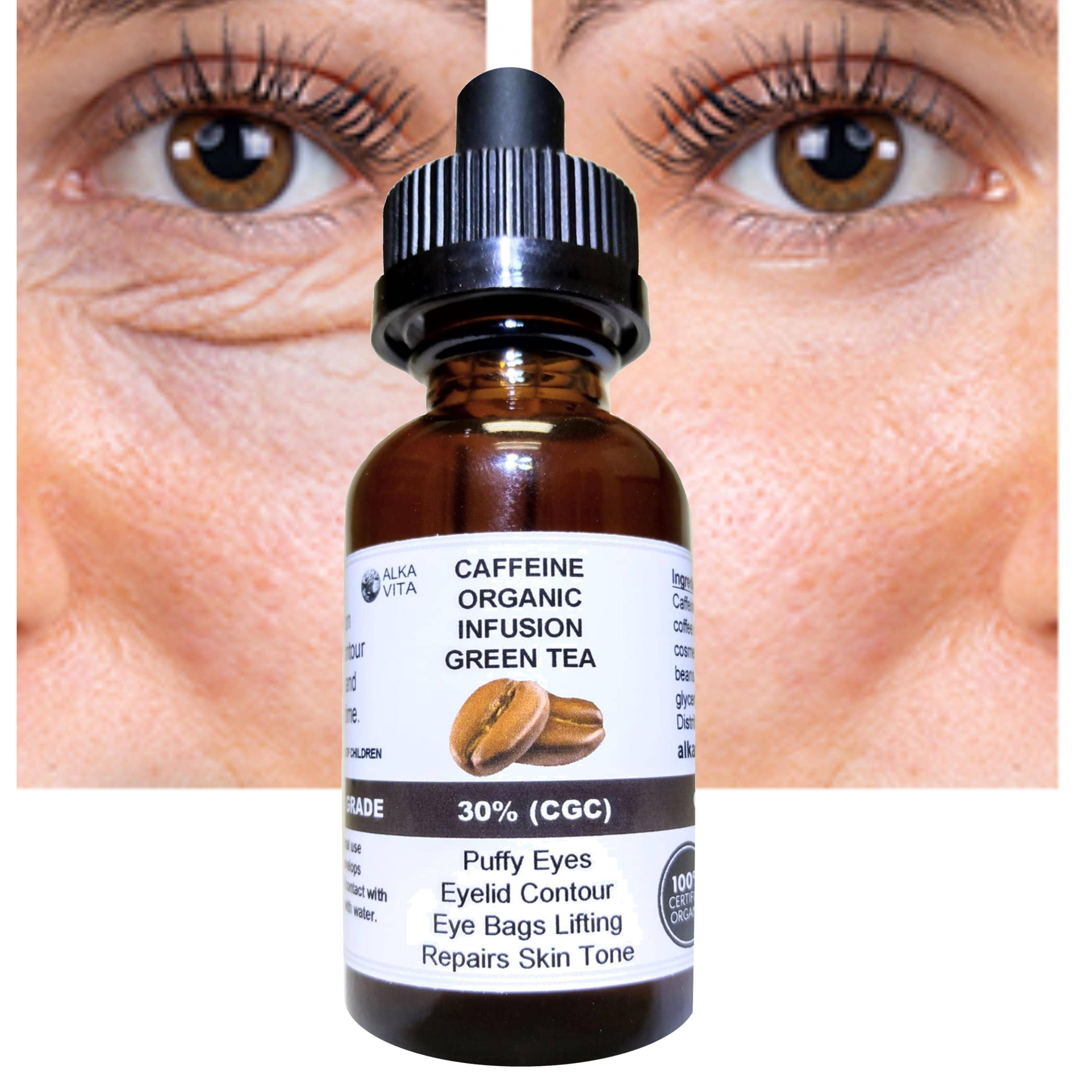 Puffy Eyes Caffeine 30% Infusion The Highest Concentration